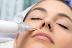 Best Actinic Keratoses Removal 3 Actinic keratoses Ely solutions - book in today!