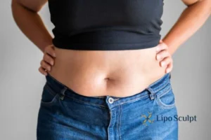 Bidding Farewell to Muffin Tops with Aqualyx Fat Injections 2 Do you wish you could reduce your muffin top Ely With Aqualy fat dissolving injections you can!