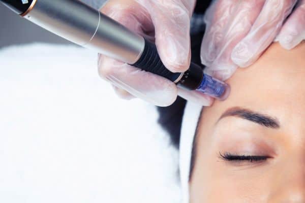 Explaining Total Skin Tightening Treatment and What to Expect 2 What Skin Concerns Can Total Skin Tightening Treatment Help With Ely?