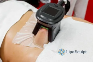 Does Fat Freezing At Home Work? 3 Fat freezing at home from Lipo Sculpt Ely